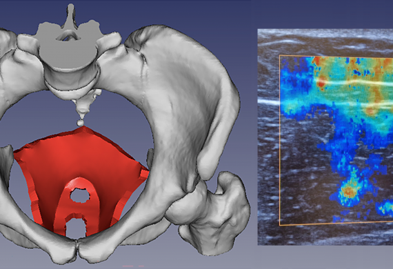 PelvicMIM – A Multimodal Imaging Matrix for enhanced diagnosis and understanding of childbirth-related Pelvic floor muscle injuries